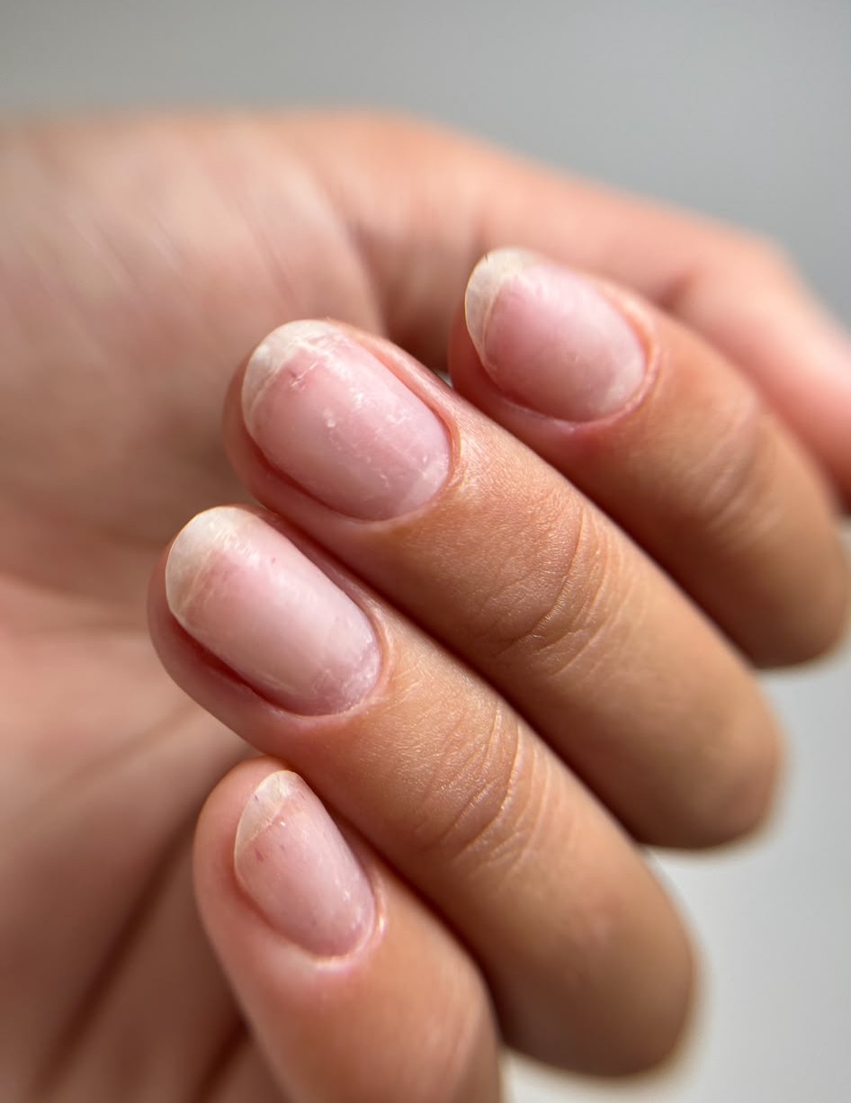 Exemple d’ongles naturels et de cuticules